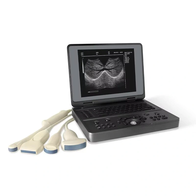 Full Digital Ultrasound Machine