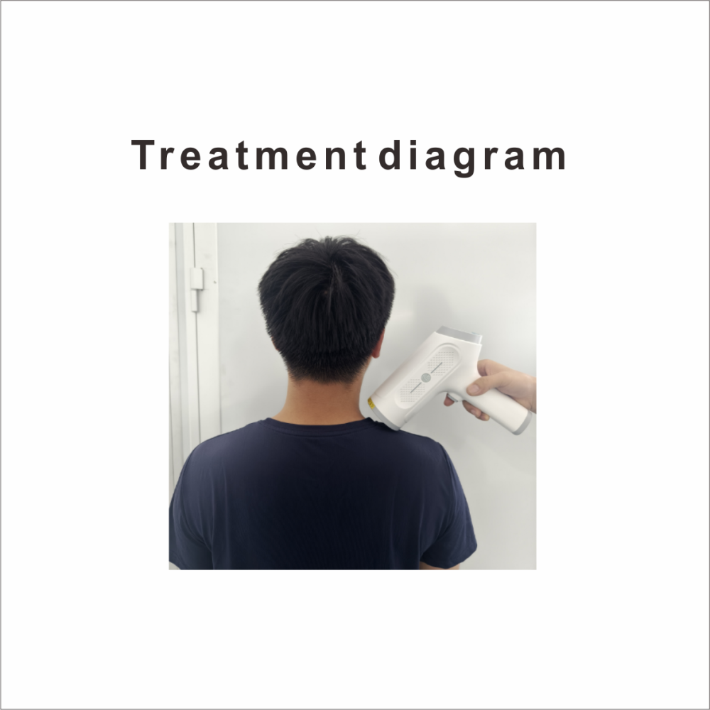 Handheld Microwave Therapy Device