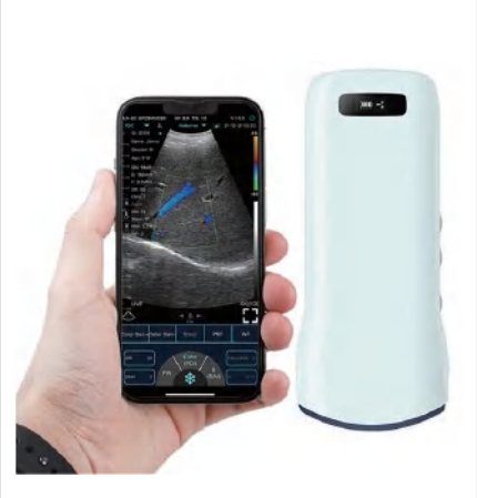 HD Color Doppler Wireless & USB Convex Probe