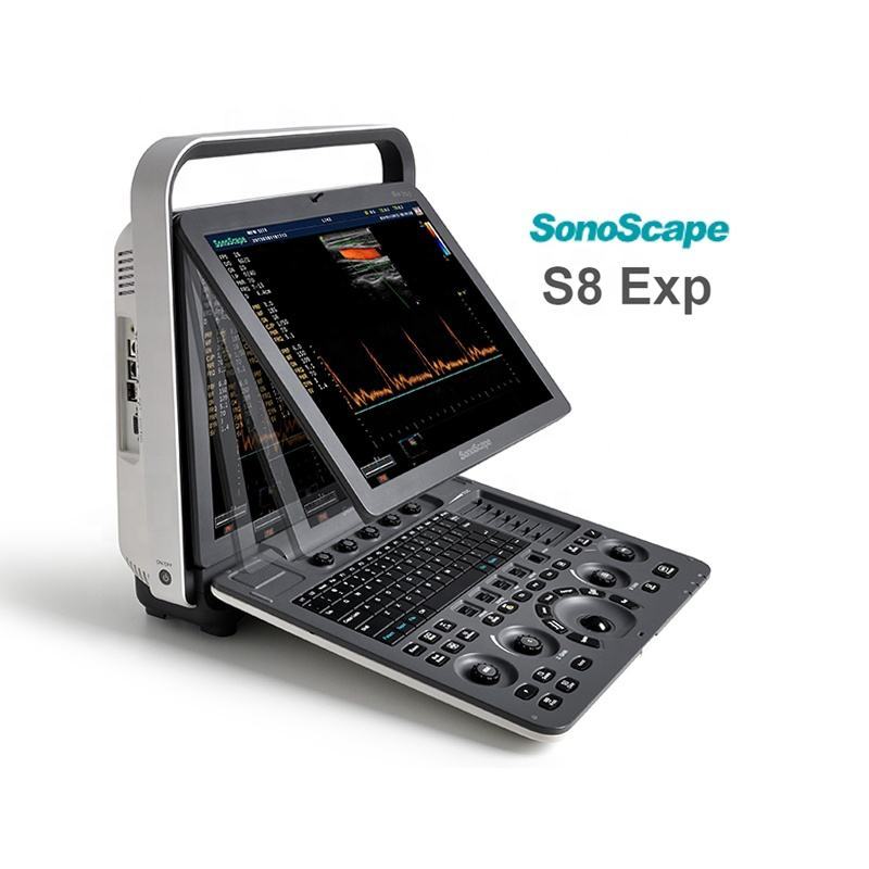 Laptop Color Doppler Ultrasound System  SonoScape S8Exp