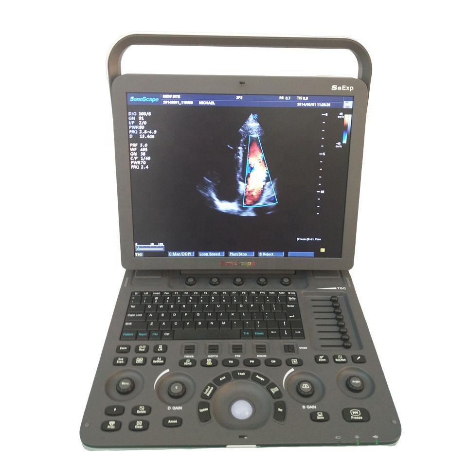 Laptop Color Doppler Ultrasound System  SonoScape S8Exp