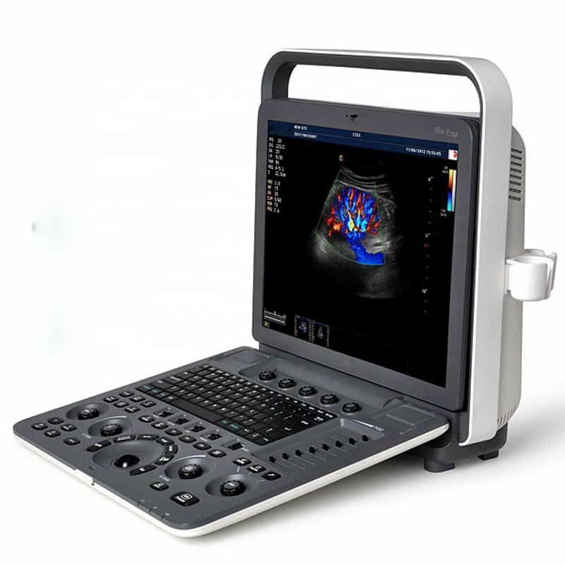 Laptop Color Doppler Ultrasound System  SonoScape S8Exp