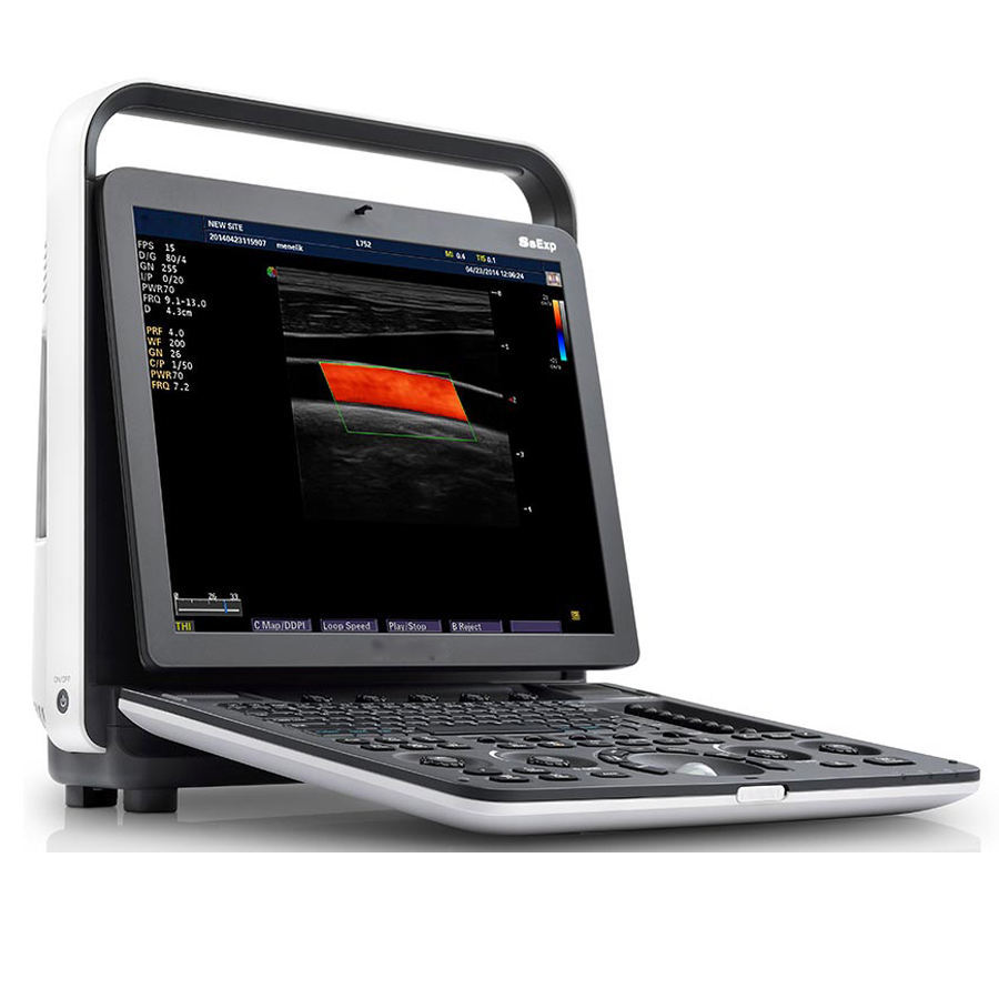 Laptop Color Doppler Ultrasound System  SonoScape S8Exp