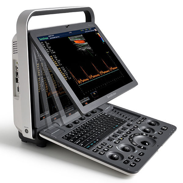 Laptop Color Doppler Ultrasound System  SonoScape S8Exp