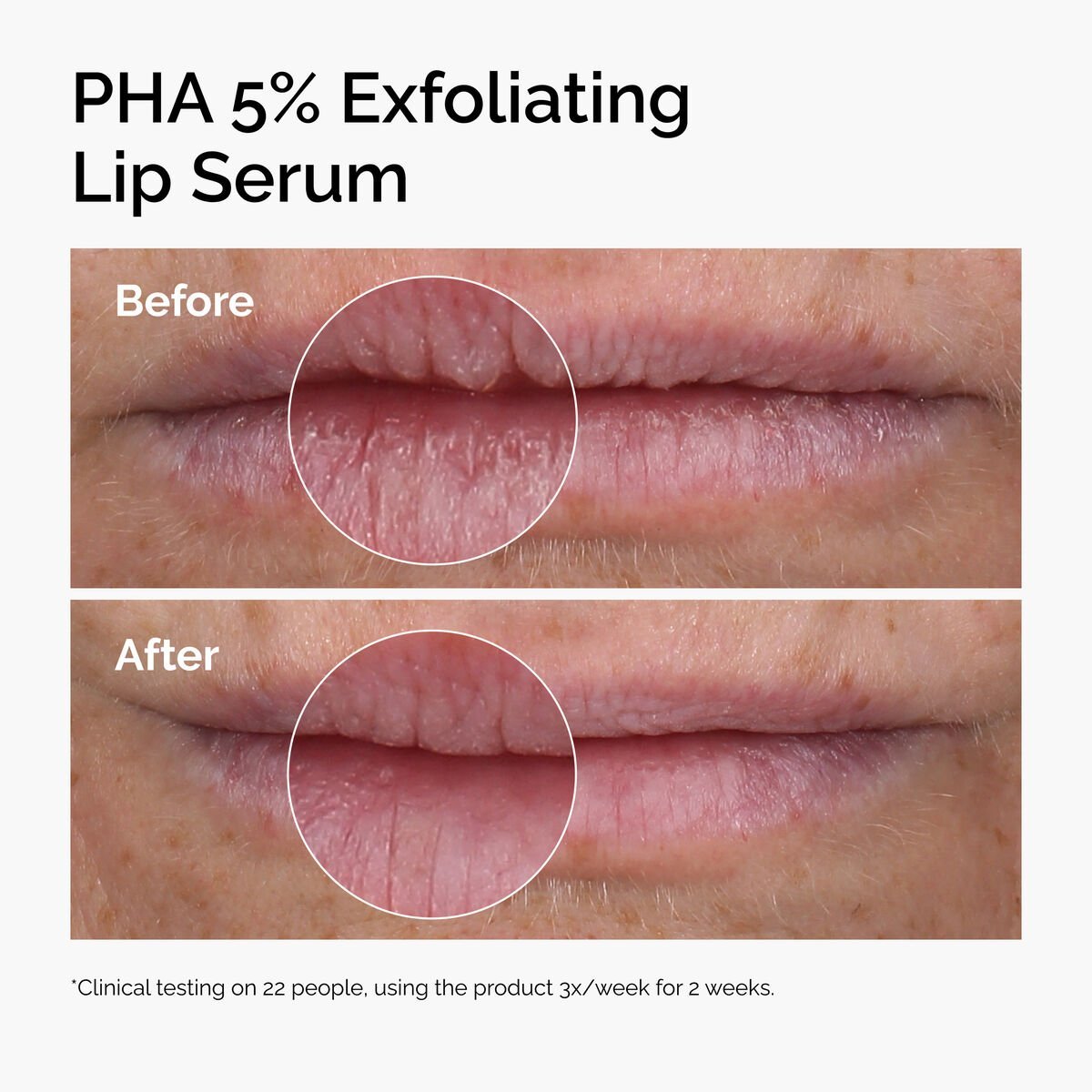Ceramide-PHA 5% Exfoliating Lip Serum,Ceramide-PHA 5% Exfoliating Lip Serum 