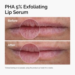 Ceramide-PHA 5% Exfoliating Lip Serum,Ceramide-PHA 5% Exfoliating Lip Serum 