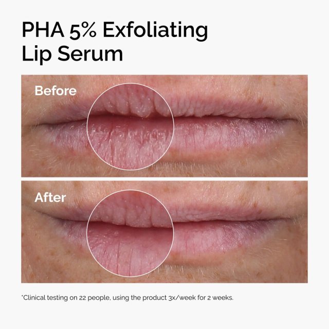 Ceramide-PHA 5% Exfoliating Lip Serum,Ceramide-PHA 5% Exfoliating Lip Serum 