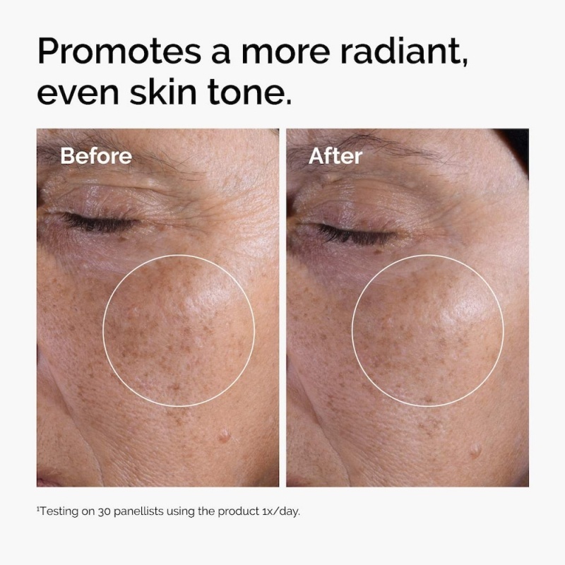 Salicylic Acid 2% Exfoliating Toner,Salicylic Acid 2% Exfoliating Toner 