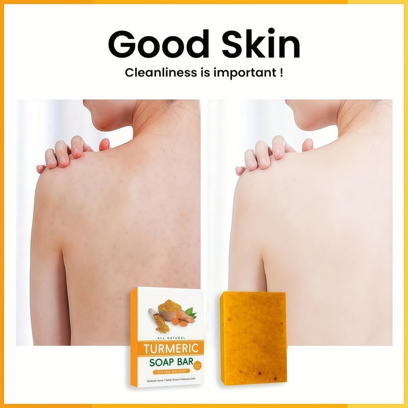 Turmeric and Kojic Acid Brightening Bath Soap,Turmeric and Kojic Acid Brightening Bath Soap 