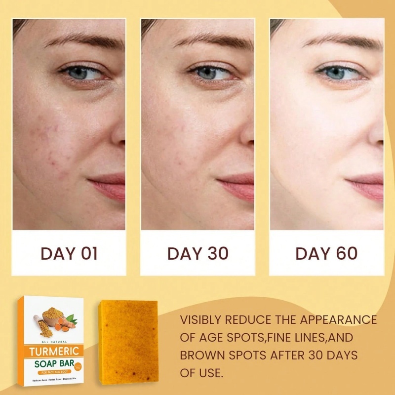 Turmeric and Kojic Acid Brightening Bath Soap,Turmeric and Kojic Acid Brightening Bath Soap 