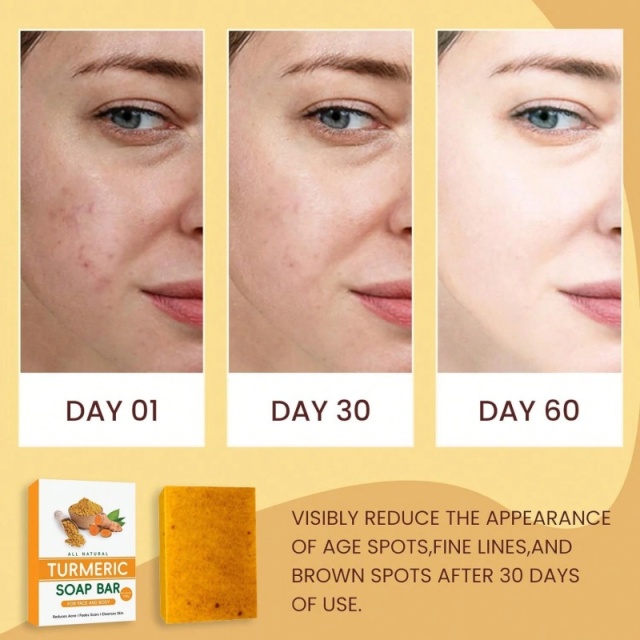 Turmeric and Kojic Acid Brightening Bath Soap,Turmeric and Kojic Acid Brightening Bath Soap 