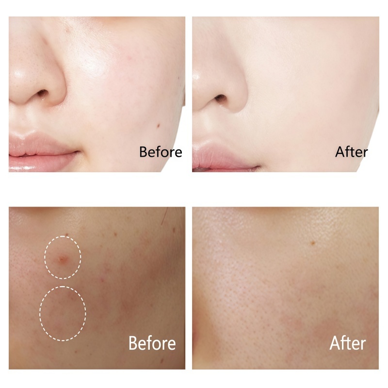 Niacinamide Retinol Miracle Cream,Niacinamide Retinol Miracle Cream 