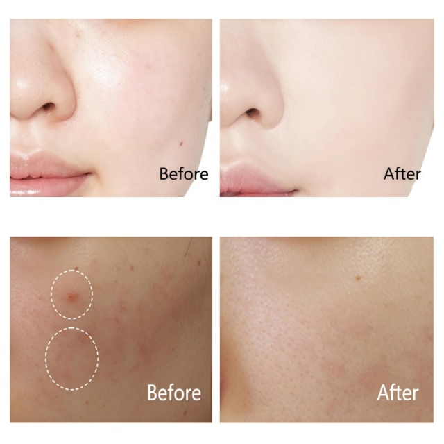 Niacinamide Retinol Miracle Cream,Niacinamide Retinol Miracle Cream 