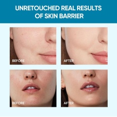 5X Ceramide Barrier Repair Moisture Gel,5X Ceramide Barrier Repair Moisture Gel 