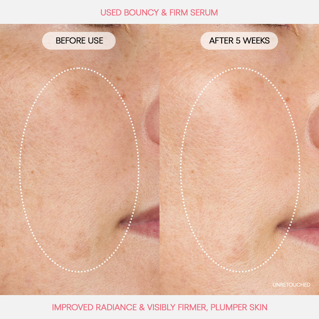 Bouncy & Firm Peony Collagen B2B Professional Serum,Bouncy & Firm Peony Collagen B2B Professional Serum 