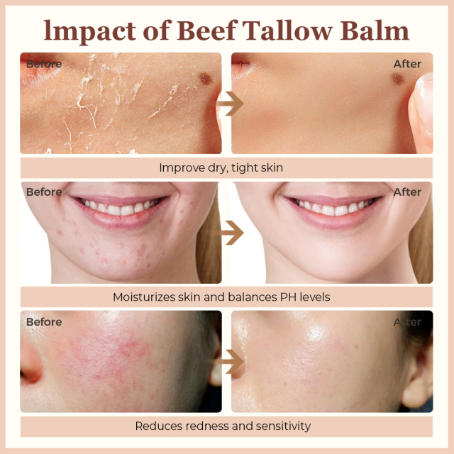 Grass-Fed Beef Tallow Cream Bulk Supplier | Beauty Salon Natural Skincare Wholesaler,Grass-Fed Beef Tallow Cream Bulk Supplier | Beauty Salon Natural Skincare Wholesaler 
