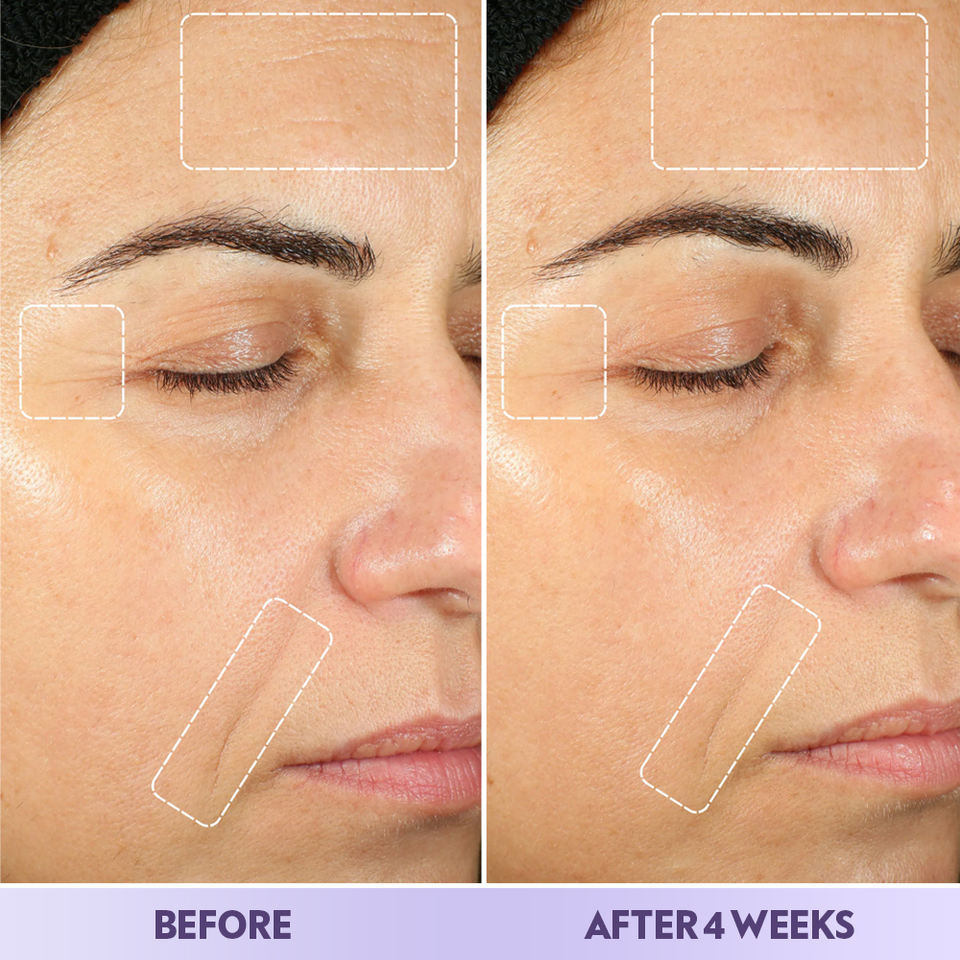 Anti-Wrinkle 5-Piece Skincare Set Bulk Supplier | Beauty Salon Anti-Aging Skincare Wholesaler,Anti-Wrinkle 5-Piece Skincare Set Bulk Supplier | Beauty Salon Anti-Aging Skincare Wholesaler 
