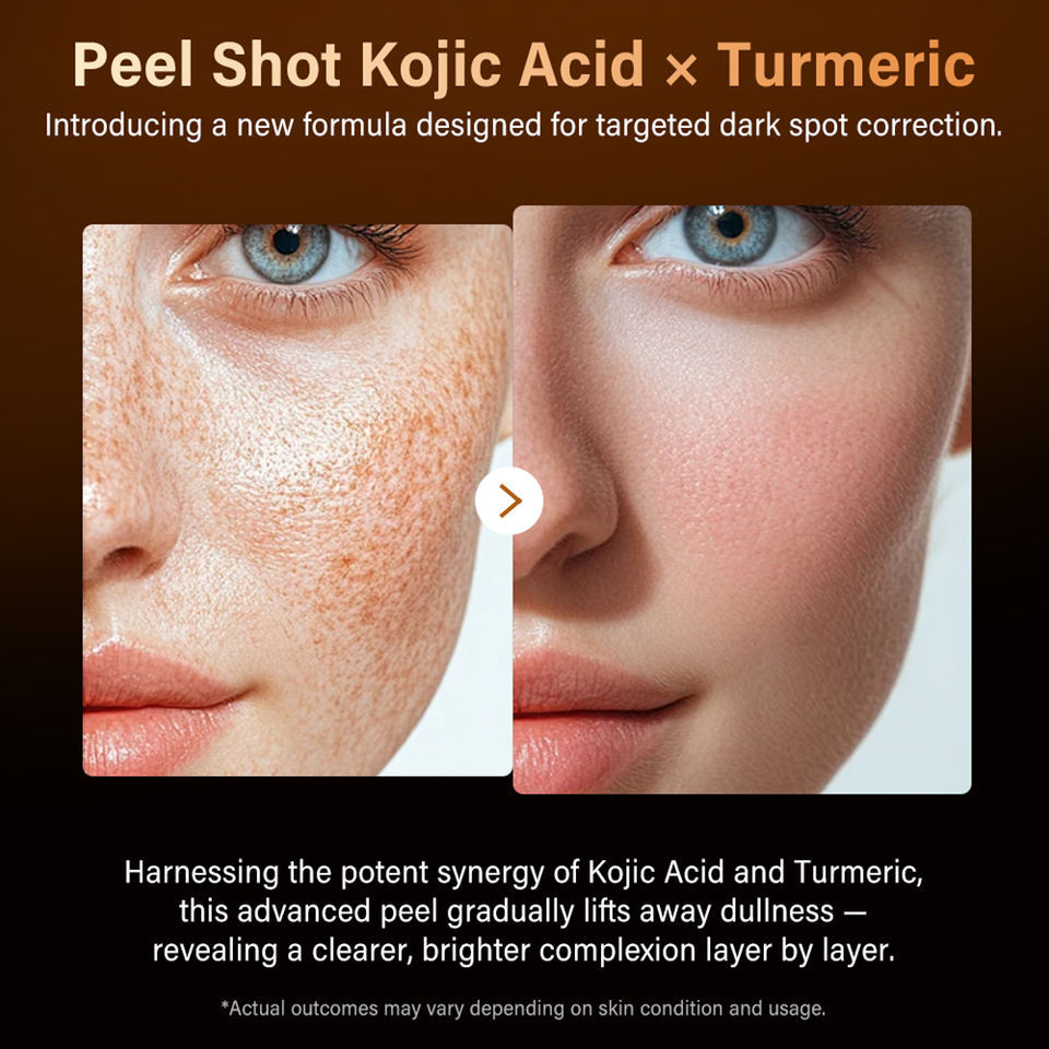Kojic Acid Turmeric Exfoliating Serum Bulk Supplier | Beauty Salon Brightening & Dark Spot Skincare Wholesaler,Kojic Acid Turmeric Exfoliating Serum Bulk Supplier | Beauty Salon Brightening & Dark Spot Skincare Wholesaler 