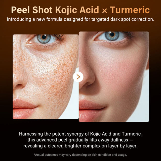 Kojic Acid Turmeric Exfoliating Serum Bulk Supplier | Beauty Salon Brightening & Dark Spot Skincare Wholesaler,Kojic Acid Turmeric Exfoliating Serum Bulk Supplier | Beauty Salon Brightening & Dark Spot Skincare Wholesaler 