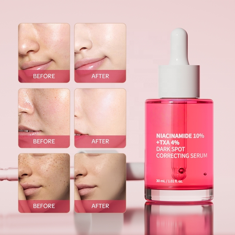 Niacinamide 10% + TXA 4% Dark Spot Correcting Serum Bulk Supplier | Beauty Salon Brightening Skincare Wholesaler,Niacinamide 10% + TXA 4% Dark Spot Correcting Serum Bulk Supplier | Beauty Salon Brightening Skincare Wholesaler 