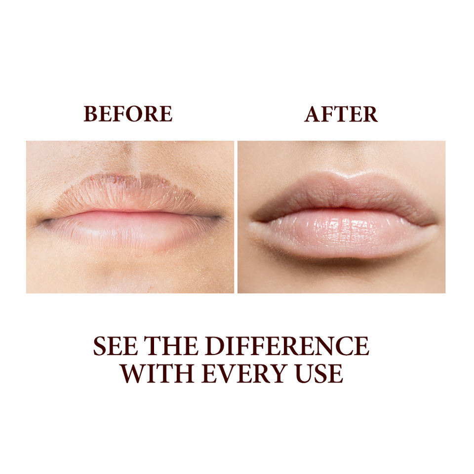 Grass-Fed Tallow Lip Balm - Daily & Nighttime Lip Care Wholesale Supplier,Grass-Fed Tallow Lip Balm - Daily & Nighttime Lip Care Wholesale Supplier 