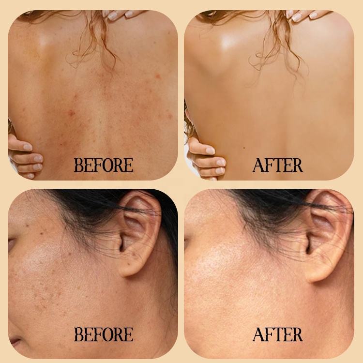 Papaya Brightening Skincare Set Bulk Supplier | B2B Beauty Salon & Skincare Brand OEM/ODM Wholesaler,Papaya Brightening Skincare Set Bulk Supplier | B2B Beauty Salon & Skincare Brand OEM/ODM Wholesaler 