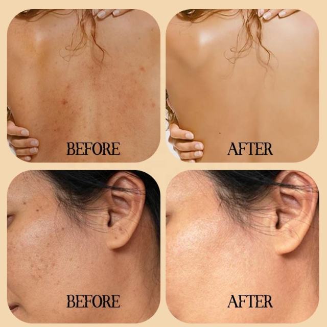 Papaya Brightening Skincare Set Bulk Supplier | B2B Beauty Salon & Skincare Brand OEM/ODM Wholesaler,Papaya Brightening Skincare Set Bulk Supplier | B2B Beauty Salon & Skincare Brand OEM/ODM Wholesaler 