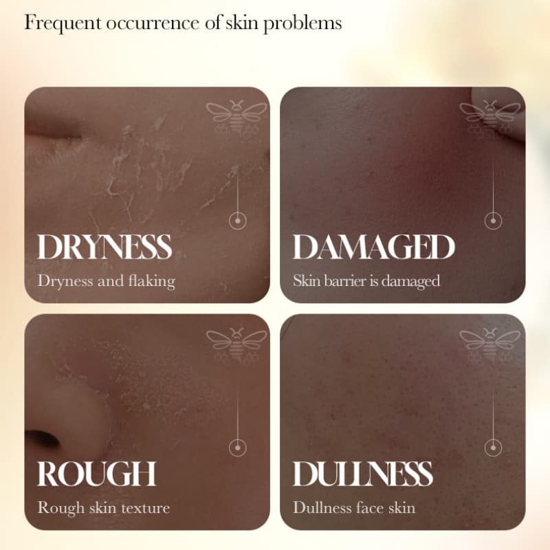Nourishing, Rejuvenating & Moisturizing Propolis Toner OEM Manufacturer & Supplier,Nourishing, Rejuvenating & Moisturizing Propolis Toner OEM Manufacturer & Supplier 