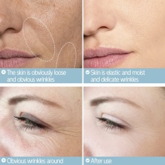 Anti-Wrinkle, Dark Spot-Fading, Hydrating & Brightening Serum with Dropper OEM Manufacturer & Supplier,Anti-Wrinkle, Dark Spot-Fading, Hydrating & Brightening Serum with Dropper OEM Manufacturer & Supplier 