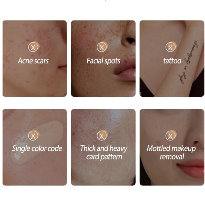 Freckle Concealer, Blemish Concealer Foundation, Acne Scar Concealer OEM Manufacturer & Supplier,Freckle Concealer, Blemish Concealer Foundation, Acne Scar Concealer OEM Manufacturer & Supplier 