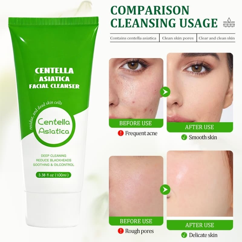 Centella Asiatica Facial Cleanser | Deep Clean Pores, Calm Irritated Skin & Control Excess Oil,Centella Asiatica Facial Cleanser | Deep Clean Pores, Calm Irritated Skin & Control Excess Oil 