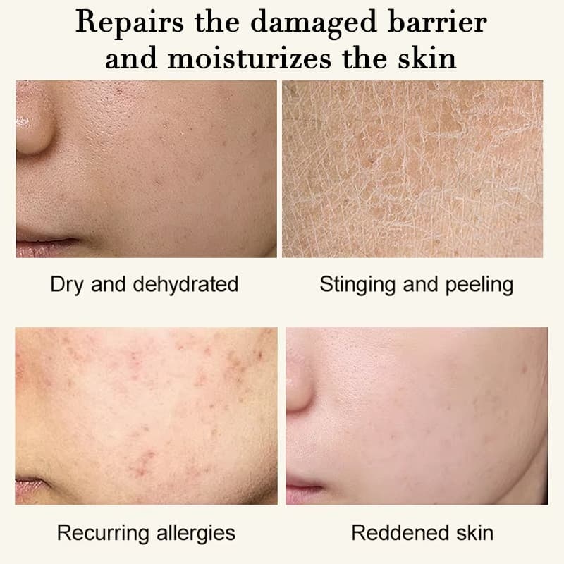 Emergency Soothing Facial Serum, Calming Redness & Hydrating Sensitive Irritated Skin Serum,Emergency Soothing Facial Serum, Calming Redness & Hydrating Sensitive Irritated Skin Serum 