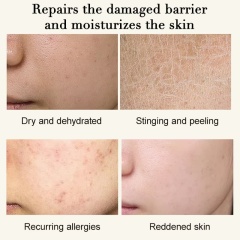Emergency Soothing Facial Serum, Calming Redness & Hydrating Sensitive Irritated Skin Serum,Emergency Soothing Facial Serum, Calming Redness & Hydrating Sensitive Irritated Skin Serum 