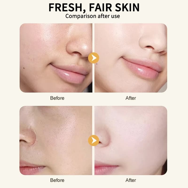 Emergency Soothing Facial Serum, Calming Redness & Hydrating Sensitive Irritated Skin Serum,Emergency Soothing Facial Serum, Calming Redness & Hydrating Sensitive Irritated Skin Serum 