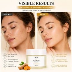 Turmeric Cream | Natural Turmeric Extract to Nourish Skin, Brighten Complexion & Balance Uneven Skin Tone,Turmeric Cream | Natural Turmeric Extract to Nourish Skin, Brighten Complexion & Balance Uneven Skin Tone 
