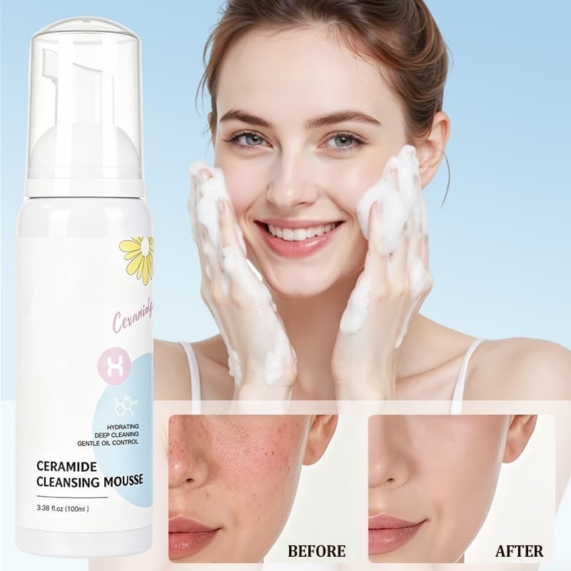 Ceramide Cleansing Mousse | Hydrating, Gentle & Oil-Controlling Foam Cleanser for Deep, Non-Stripping Clean,Ceramide Cleansing Mousse | Hydrating, Gentle & Oil-Controlling Foam Cleanser for Deep, Non-Stripping Clean 
