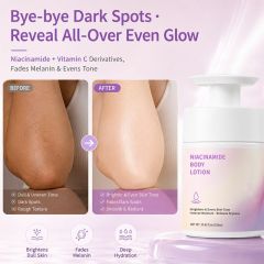 Niacinamide Body Lotion | 3-in-1 Formula to Relieve Dryness, Boost Moisture & Brighten Uneven Skin Tone,Niacinamide Body Lotion | 3-in-1 Formula to Relieve Dryness, Boost Moisture & Brighten Uneven Skin Tone 