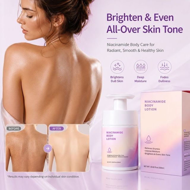 Niacinamide Body Lotion | 3-in-1 Formula to Relieve Dryness, Boost Moisture & Brighten Uneven Skin Tone,Niacinamide Body Lotion | 3-in-1 Formula to Relieve Dryness, Boost Moisture & Brighten Uneven Skin Tone 