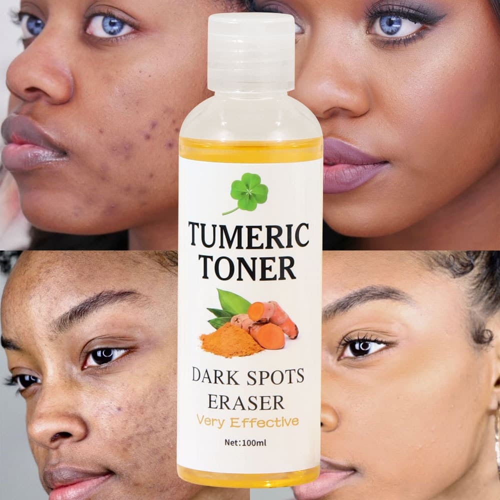 Turmeric Toner For Brightening & Dark Spot Removal B2B Manufacturer & Supplier,Turmeric Toner For Brightening & Dark Spot Removal B2B Manufacturer & Supplier 