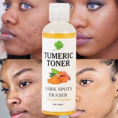 Turmeric Toner For Brightening & Dark Spot Removal B2B Manufacturer & Supplier,Turmeric Toner For Brightening & Dark Spot Removal B2B Manufacturer & Supplier 
