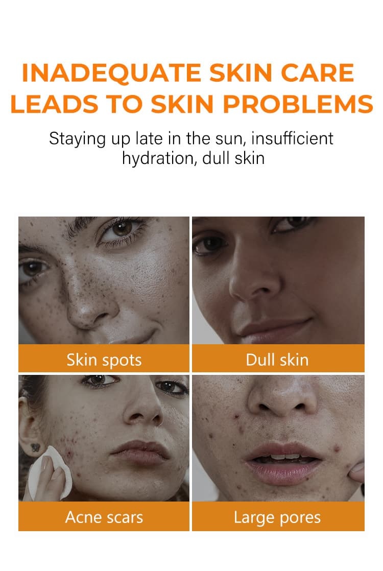 Turmeric Toner For Brightening & Dark Spot Removal B2B Manufacturer & Supplier,Turmeric Toner For Brightening & Dark Spot Removal B2B Manufacturer & Supplier 