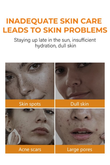Turmeric Toner For Brightening & Dark Spot Removal B2B Manufacturer & Supplier,Turmeric Toner For Brightening & Dark Spot Removal B2B Manufacturer & Supplier 