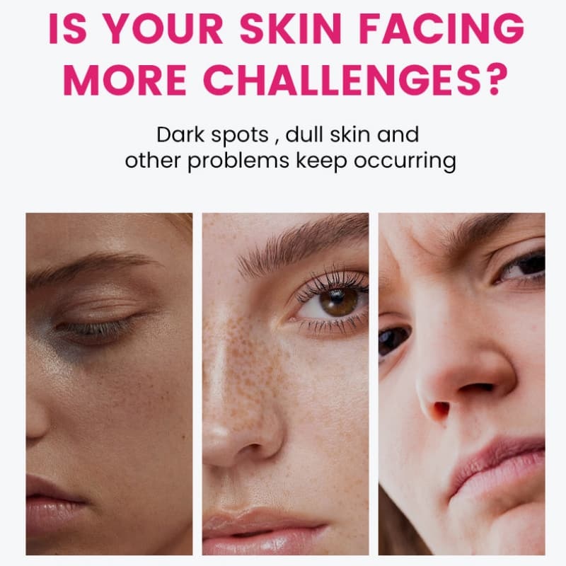 7% Arbutin + 4% Tranexamic Acid Cream, Skin Purifying Niacinamide & Glutathione Lotion, Emulsion & Cream,7% Arbutin + 4% Tranexamic Acid Cream, Skin Purifying Niacinamide & Glutathione Lotion, Emulsion & Cream 