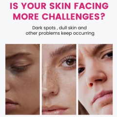 7% Arbutin + 4% Tranexamic Acid Cream, Skin Purifying Niacinamide & Glutathione Lotion, Emulsion & Cream,7% Arbutin + 4% Tranexamic Acid Cream, Skin Purifying Niacinamide & Glutathione Lotion, Emulsion & Cream 
