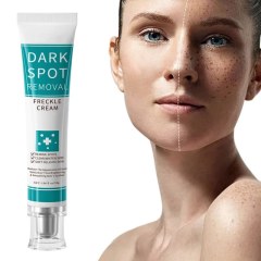 Dark Spot Removal Cream | Fade Freckles & Hyperpigmentation, Brighten & Soften Dull Uneven Skin,Dark Spot Removal Cream | Fade Freckles & Hyperpigmentation, Brighten & Soften Dull Uneven Skin 