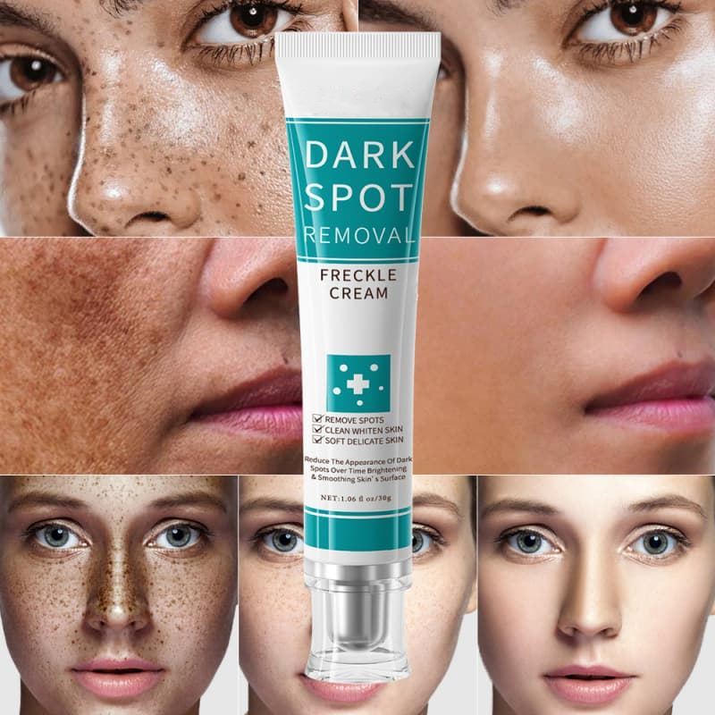 Dark Spot Removal Cream | Fade Freckles & Hyperpigmentation, Brighten & Soften Dull Uneven Skin,Dark Spot Removal Cream | Fade Freckles & Hyperpigmentation, Brighten & Soften Dull Uneven Skin 