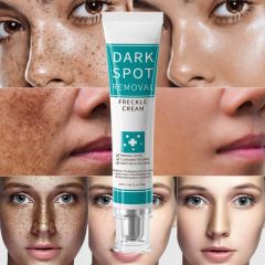 Dark Spot Removal Cream | Fade Freckles & Hyperpigmentation, Brighten & Soften Dull Uneven Skin,Dark Spot Removal Cream | Fade Freckles & Hyperpigmentation, Brighten & Soften Dull Uneven Skin 