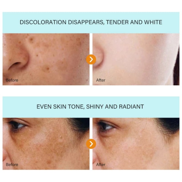 Dark Spot Removal Cream | Fade Freckles & Hyperpigmentation, Brighten & Soften Dull Uneven Skin,Dark Spot Removal Cream | Fade Freckles & Hyperpigmentation, Brighten & Soften Dull Uneven Skin 