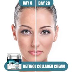 Retinol Collagen Day&Night Cream | 5% Hyaluronic Acid Deep Hydration Anti-Wrinkle Firming Facial Moisturizer,Retinol Collagen Day&Night Cream | 5% Hyaluronic Acid Deep Hydration Anti-Wrinkle Firming Facial Moisturizer 