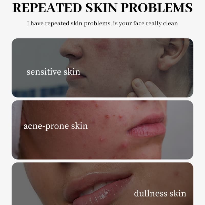 2% Salicylic Acid Cleanser | Oil Control & Minimize Pores, Hydrate & Protect Skin Barrier with Niacinamide & Ceramide,2% Salicylic Acid Cleanser | Oil Control & Minimize Pores, Hydrate & Protect Skin Barrier with Niacinamide & Ceramide 